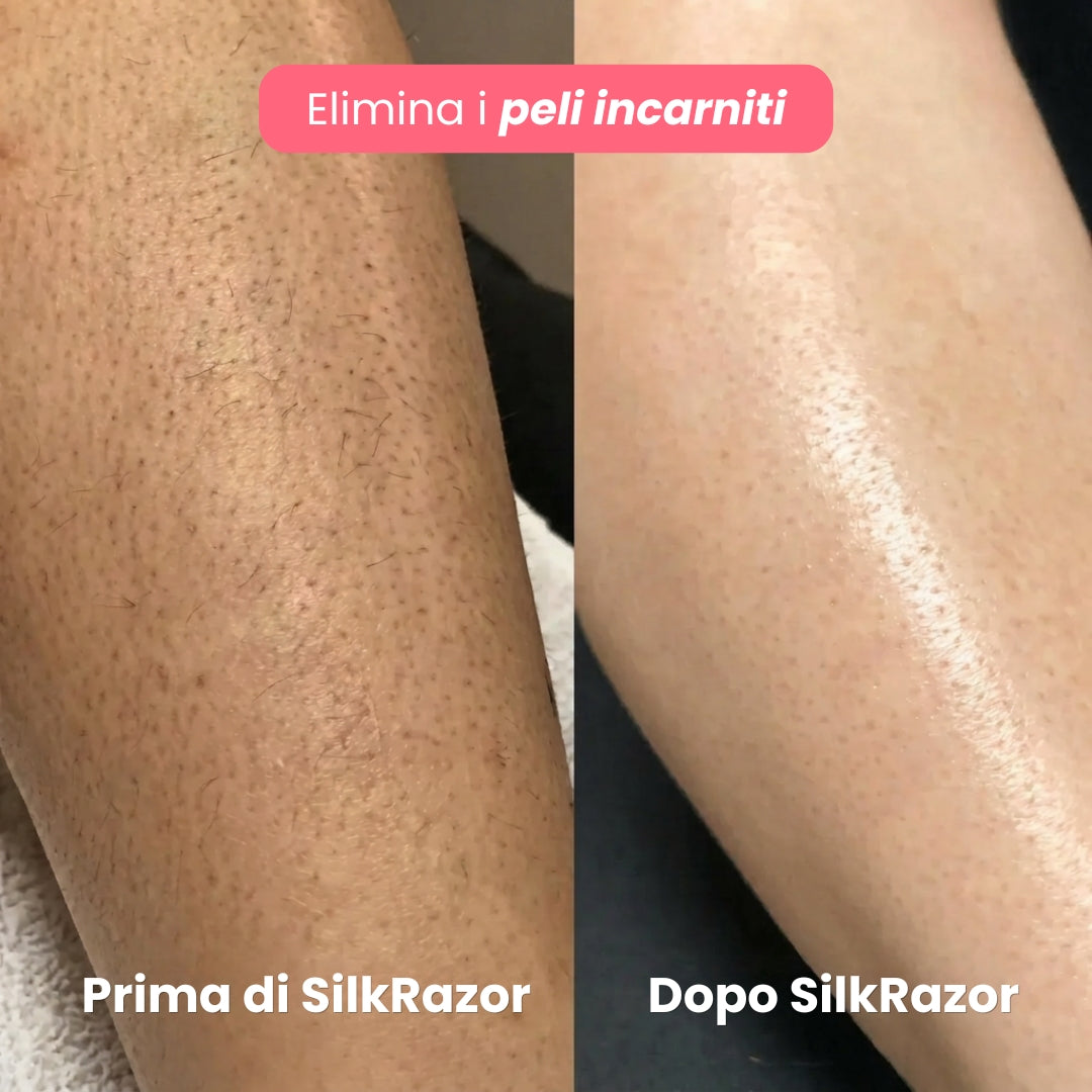 SilkRazor Pro 2 in 1 – Rasoio Elettrico Donna Bikini & Corpo