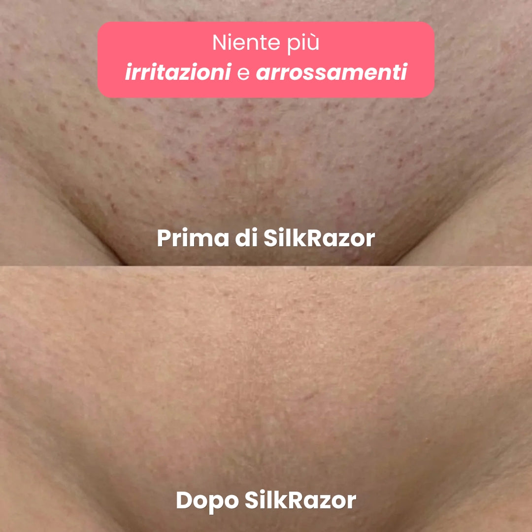SilkRazor Pro 2 in 1 – Rasoio Elettrico Donna Bikini & Corpo